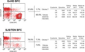 Gráficas de puntos que representan el porcentaje de tipos celulares encontrados en el líquido de las ampollas cutáneas mediante análisis citométrico de flujo. El cuadrado LR (CD3− CD56+) ilustra las células NK. El primer diagrama muestra los datos de nuestra paciente, con un 65,5% de células NK. El diagrama inferior es un ejemplo de un caso de SJS/TEN, con sólo un 7,6% de células NK. GvHD: enfermedad del injerto frente al huésped; BFC: células del líquido de las ampollas; SJS/TEN: síndrome de Stevens–Johnson/necrólisis epidérmica tóxica; Células NK: células asesinas naturales; UL: superior-izquierdo; UR: superior-derecho; LL: inferior-izquierdo; LR: inferior-derecho.