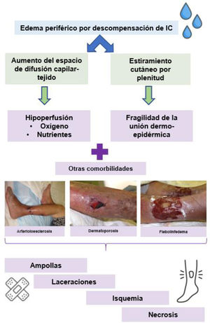 Fisiopatología y comorbilidades en las heridas por aumento del espacio de difusión.