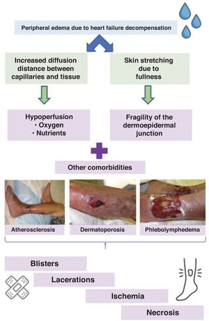 Pathophysiology and comorbidities in wounds due to increased diffusion distance.