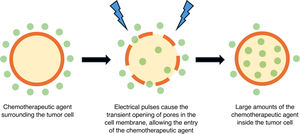 Mechanism of action of electrochemotherapy: electrical pulses induce the transient opening of pores in the cell membrane, facilitating the entry of the chemotherapeutic agent into the tumor cell and causing its destruction.