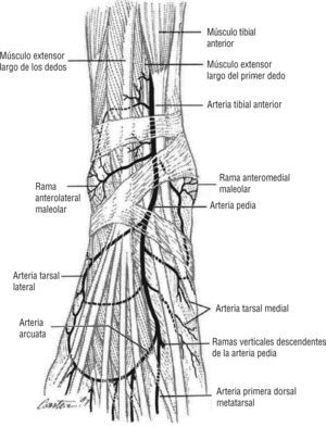 Arteria tibial anterior. Nutre todo el dorso del pie. Imagen cedida por Attinger CE et al6.