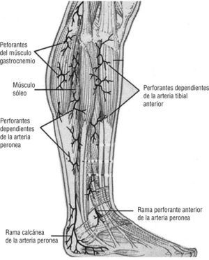 Arteria peronea. Se desplaza sobre la cara medial del peroné y nutre la región posterolateral e inferior de la pierna, el tobillo y el talón. Imagen cedida por Attinger CE et al6.