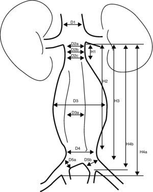Mediciones necesarias en una valoración de un REVA. D1: diámetro de la aorta suprarrenal D2a: diámetro del cuello superior infrarrenal D2b: diámetro del cuello medio infrarrenal D2c: diámetro del cuello inferior infrarrenal D3: diámetro externo del aneurisma D3a: diámetro de la luz del aneurisma D4: diámetro distal de la aorta antes de la bifurcación D5a: diámetro de la ilíaca primitiva derecha D5b: diámetro de la ilíaca primitiva izquierda H1: longitud del cuello proximal H2: longitud desde la línea infrarrenal hasta la parte distal del aneurisma H3: longitud desde la línea infrarrenal hasta la bifurcación.