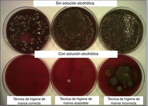 Representación microbiológica sobre placas de agar-sangre del nivel de cumplimiento de la técnica de HM.