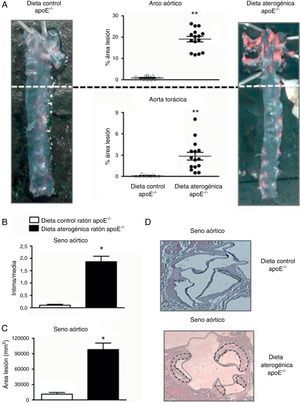 La administración de una dieta aterogénica durante 2 meses incrementó la lesión aterosclerótica en el arco aórtico, en la aorta torácica (A) y en el seno aórtico (B-D) en ratones apoE-/−. Se muestran imágenes representativas de las aortas de ratones apoE-/− sometidos o no a una dieta aterogénica (A). La ratio íntima/media (B) y el área de la lesión (mm2) (C). También se muestran imágenes representativas del seno aórtico de los diferentes grupos experimentales (D). Los resultados están expresados como la media±ESM de n=9-12 animales por grupo. *p<0,01 relativo a los valores en el grupo sometido a dieta control.
