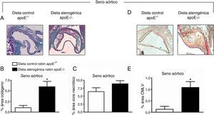 La administración de una dieta aterogénica durante 2 meses incrementó el contenido de colágeno (A) y la proliferación de la musculatura lisa vascular (D) en la lesión aterosclerótica en animales apoE-/−. Se muestran imágenes representativas de la tinción de colágeno (A) y de la inmunohistoquímica para la detección de α-actina (proliferación de musculatura lisa) (D) en la lesión aterosclerótica en el seno aórtico en ratones apoE-/− sometidos o no a una dieta aterogénica. Las barras representan el porcentaje de colágeno normalizado con respecto al área total de la lesión aterosclerótica y el porcentaje de core necrótico (B y C). Las barras muestran el número de células que expresan α-actina en la lesión (E). Los resultados están expresados como la media±ESM de n=5-7 animales por grupo. *p<0,05 relativo a los valores en el grupo sometido a dieta control.
