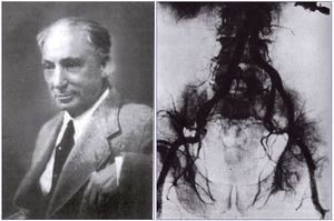 Reynaldo Dos Santos (año 1978) y su aortografía (año 1929).