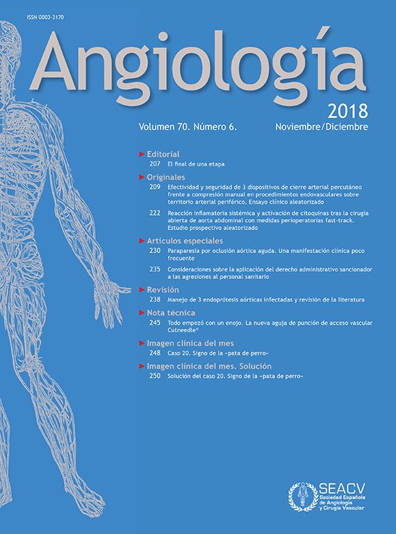 La Disección Aórtica Tipo B: Tratamiento Endovascular | Angiología