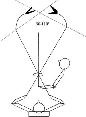 Disposición del cirujano y el ayudante. Angulación conseguida con instrumental articulado.