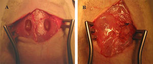 Imagen macroscópica del método usado en el estudio experimental. A) Creación de defectos herniarios. B) Hernioplastias. Izquierda: prótesis reabsorbible fijada con pegamento de fibrina. Derecha: prótesis reabsorbible fijada con sutura convencional irreabsorbible.