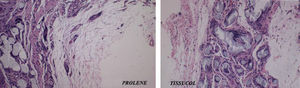 Imagen microscópica (hematoxilina-eosina, 10×) de los explantes. Izquierda: reparación mediante el uso de sutura convencional de polipropileno (Prolene®). Derecha: reparación mediante el uso de cola biológica (Tissucol®).