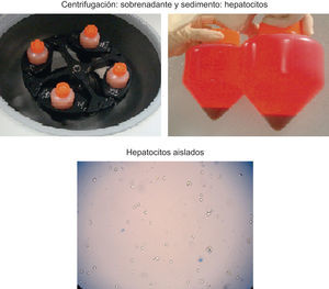 Aislamiento de los hepatocitos: centrifugación de la suspensión celular y obtención de los hepatocitos.