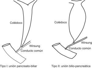 Clasificación de Kimura de las anomalías de la unión biliopancreática.