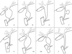 Clasificación de Todani.