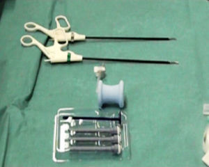 Material empleado en el abordaje transanal endoscópico: dispositivo SILS, material laparoscópico pediátrico convencional.
