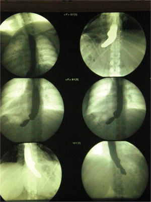 Tránsito al tercer día.
