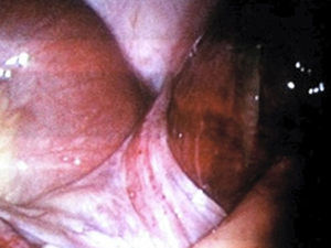 Figura 2