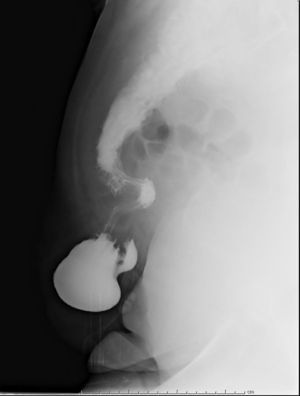 Figura 2