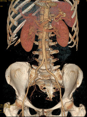 Figura 2