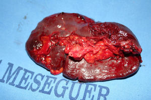 Figura 3