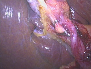 Figura 2