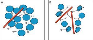 Difusión de las moléculas de agua. A) Difusión restringida en el espacio extracelular por la celularidad y la integridad de las membranas. Las moléculas de agua (círculos con flechas) se mueven con dificultad. B) Difusión libre en el espacio extracelular por la poca celularidad y existencia de membranas rotas. Las moléculas de agua se mueven libremente entra las células y atravesando las células con membranas rotas.