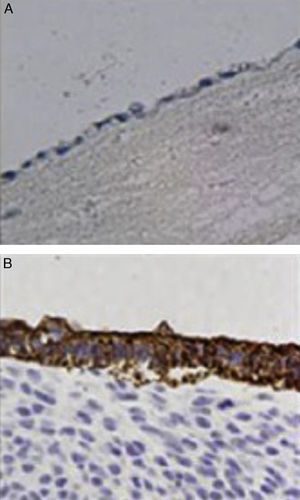 Inmunohistoquímica, reacción positiva frente al antígeno de membrana epitelial (A) y frente al antígeno de la queratina de bajo peso molecular (B) en los animales trasplantados.