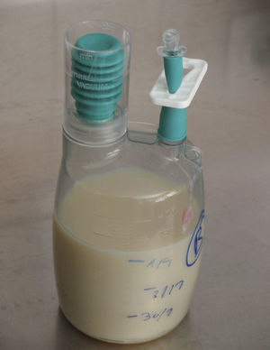 Aspecto lactescente del líquido acumulado en el dispositivo del drenaje axilar.