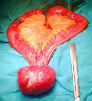 Figura 1