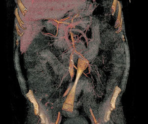 Figura 1