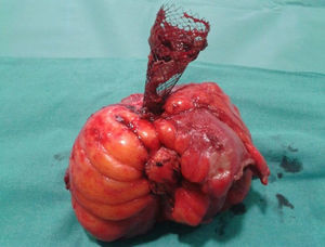 Figura 2