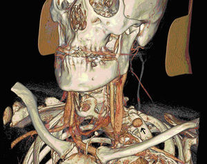 Figura 1