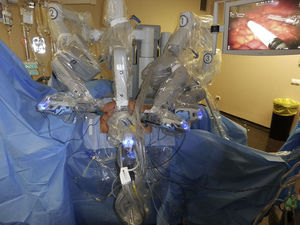 Robot anclado en abdomen desde lateral izquierdo del paciente.