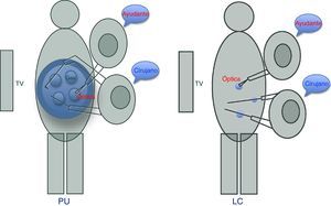 Técnicas laparoscópicas.
