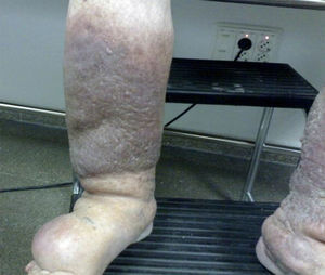 Figura 1