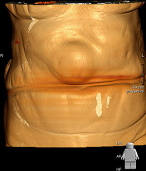 Figura 1