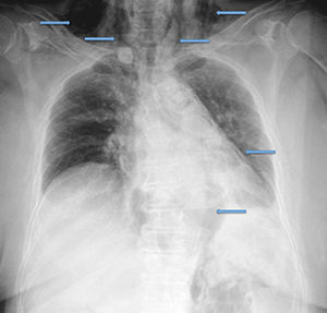 Figura 1