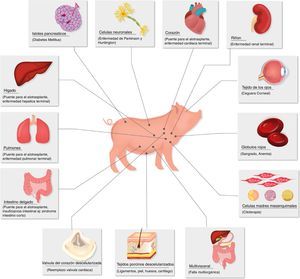 Enfermedades para las que el xenotrasplante podría ser una terapia alternativa. Fuente: Extraída de Ekser et al.73.