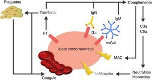 Visión esquemática de la respuesta inmediata posterior al xenotrasplante. La expresión del factor tisular y la unión de anticuerpos a antígenos Gal y noGal en los islotes porcinos neonatales lleva a la activación del complemento y de la cascada de la coagulación. Se genera formación de coágulos y daño directo de la membrana celular a través del complejo de ataque a membrana (MAC), así como reclutamiento de macrófagos y monocitos a través de los quimioatrayentes C3a y C5a. FT: factor tisular. Fuente: Extraído de van der Windt et al.28.