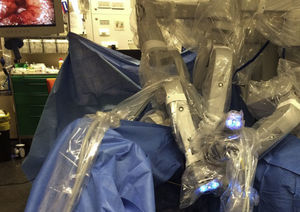 Sistema quirúrgico da Vinci Si (Intuitive Surgical, Sunnyvale, CA, EE. UU.).