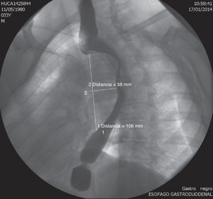 Figura 2