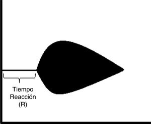 Tiempo de reacción en la tromboelastografía.