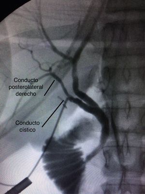 Figura 1