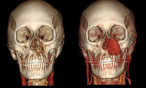 Figura 2