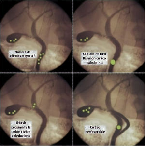 Situaciones desfavorables para el tratamiento de la litiasis biliar.