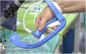 Posicionamiento del FlexDex® en relación con la mano del operador.