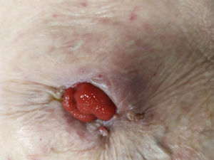 Figura 2