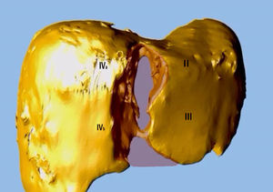 Figura 2