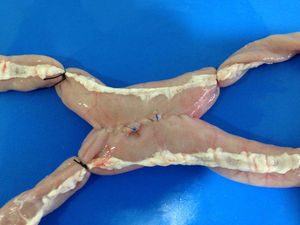 Anastomosis látero-lateral laparoscópica con víscera criopreservada ex vivo.