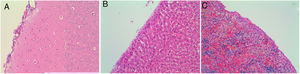 Microscopic findings on the brain, liver and spleen (A–C). Hematoxylin and eosin 200×. Systemic distribution of talc was not assessed.